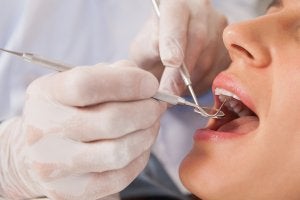 family dental care in schaumburg il